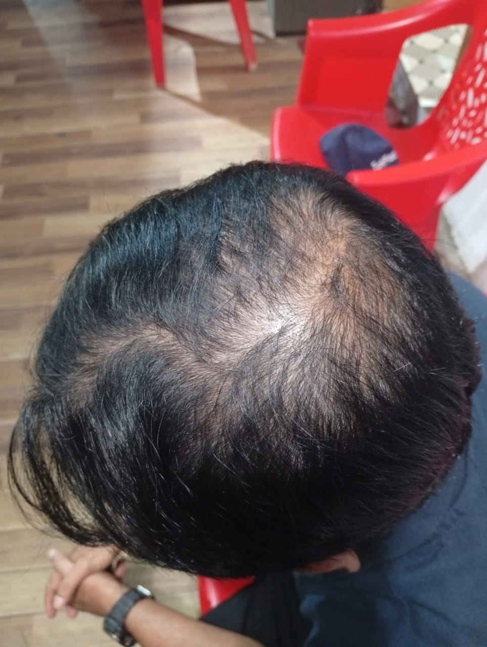 Before